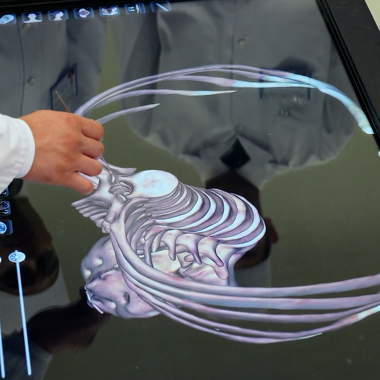 Artrosindesmologi&yacute;a. Kelle&ccedil;anak s&uuml;ňkleriniň birleşmeleri. Anatomage 3D enjamynda amaly sapak